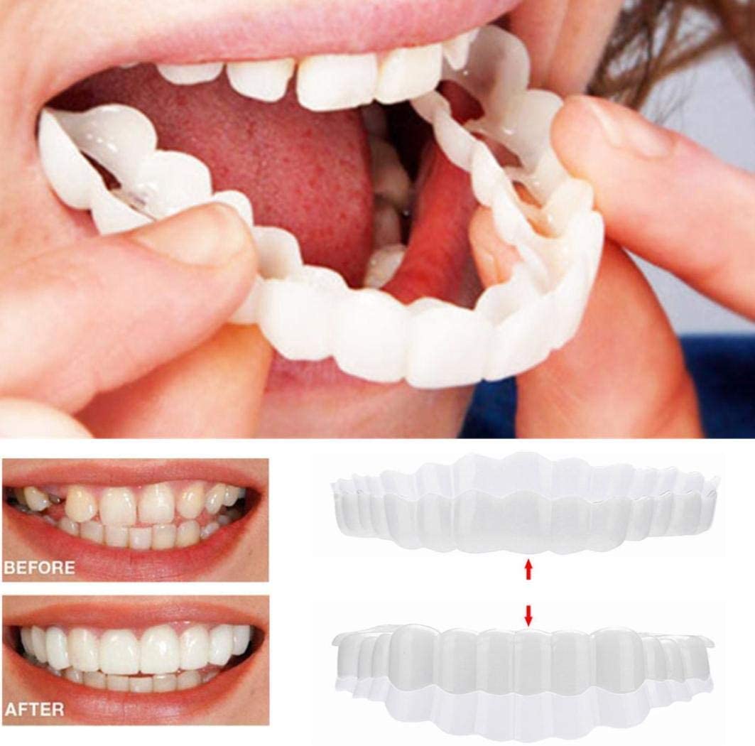 Dental Impression Smile Veneer Set for Men & Women - Lexians