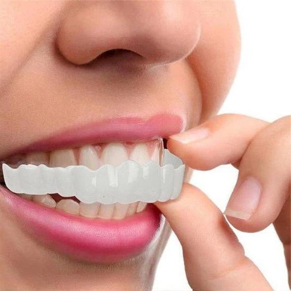 Dental Impression Smile Veneer Set for Men & Women - Lexians