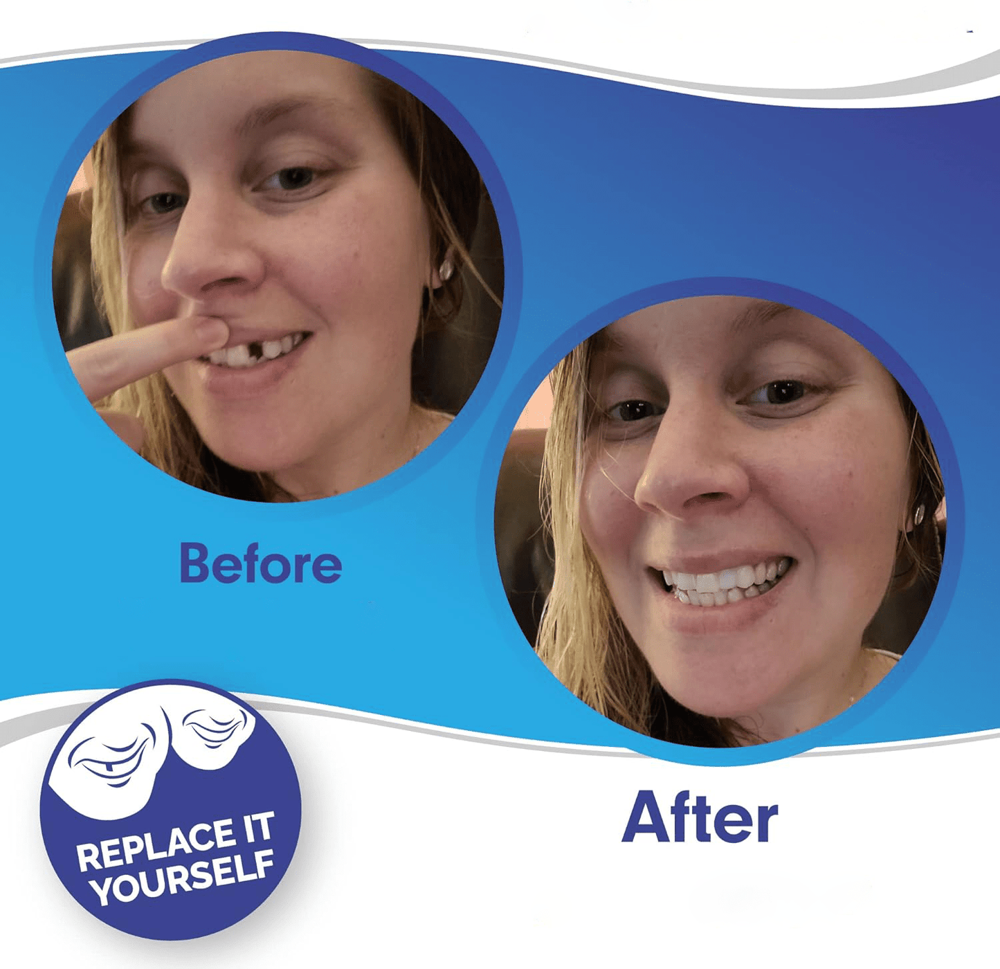 Dental Impression Smile Veneer Set for Men & Women - Lexians