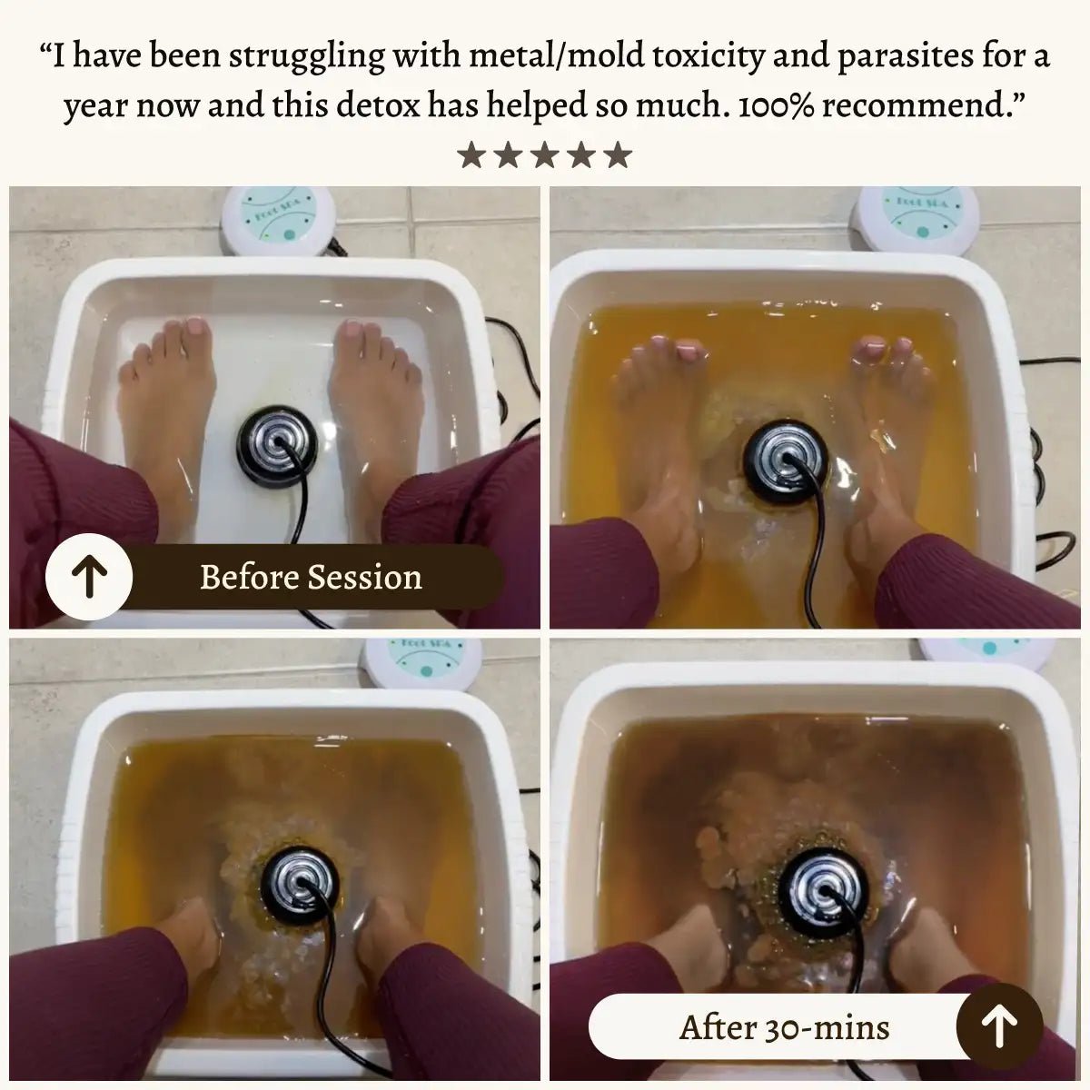 Detoxifying Ionic Foot Spa for Healthier Living - Lexians