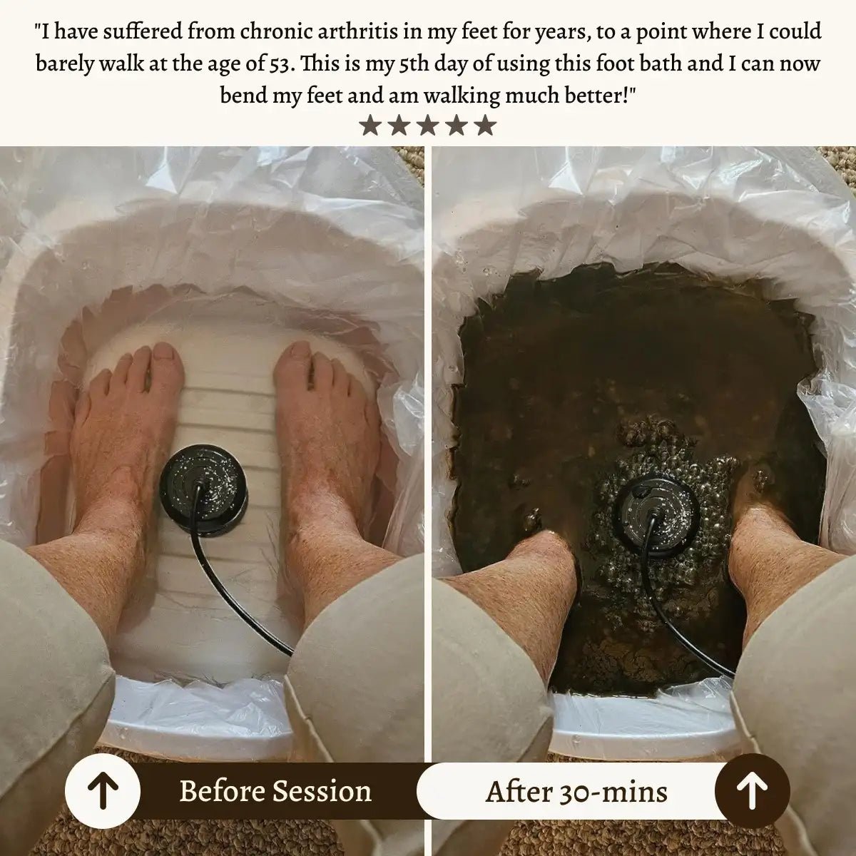 Detoxifying Ionic Foot Spa for Healthier Living - Lexians