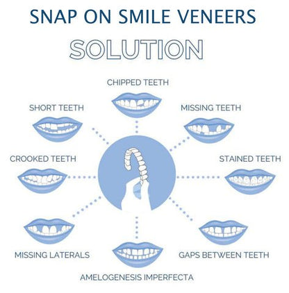 Dental Impression Smile Veneer Set for Men & Women - Lexians