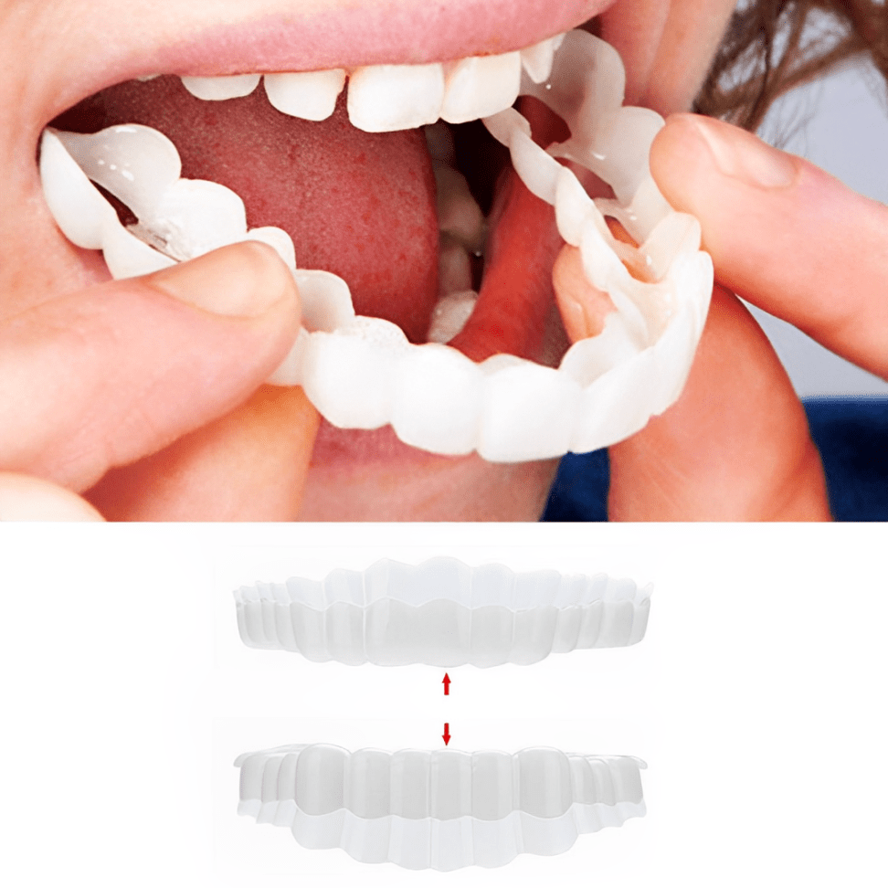 Dental Impression Smile Veneer Set for Men & Women - Lexians