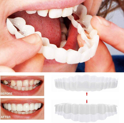Dental Impression Smile Veneer Set for Men & Women - Lexians