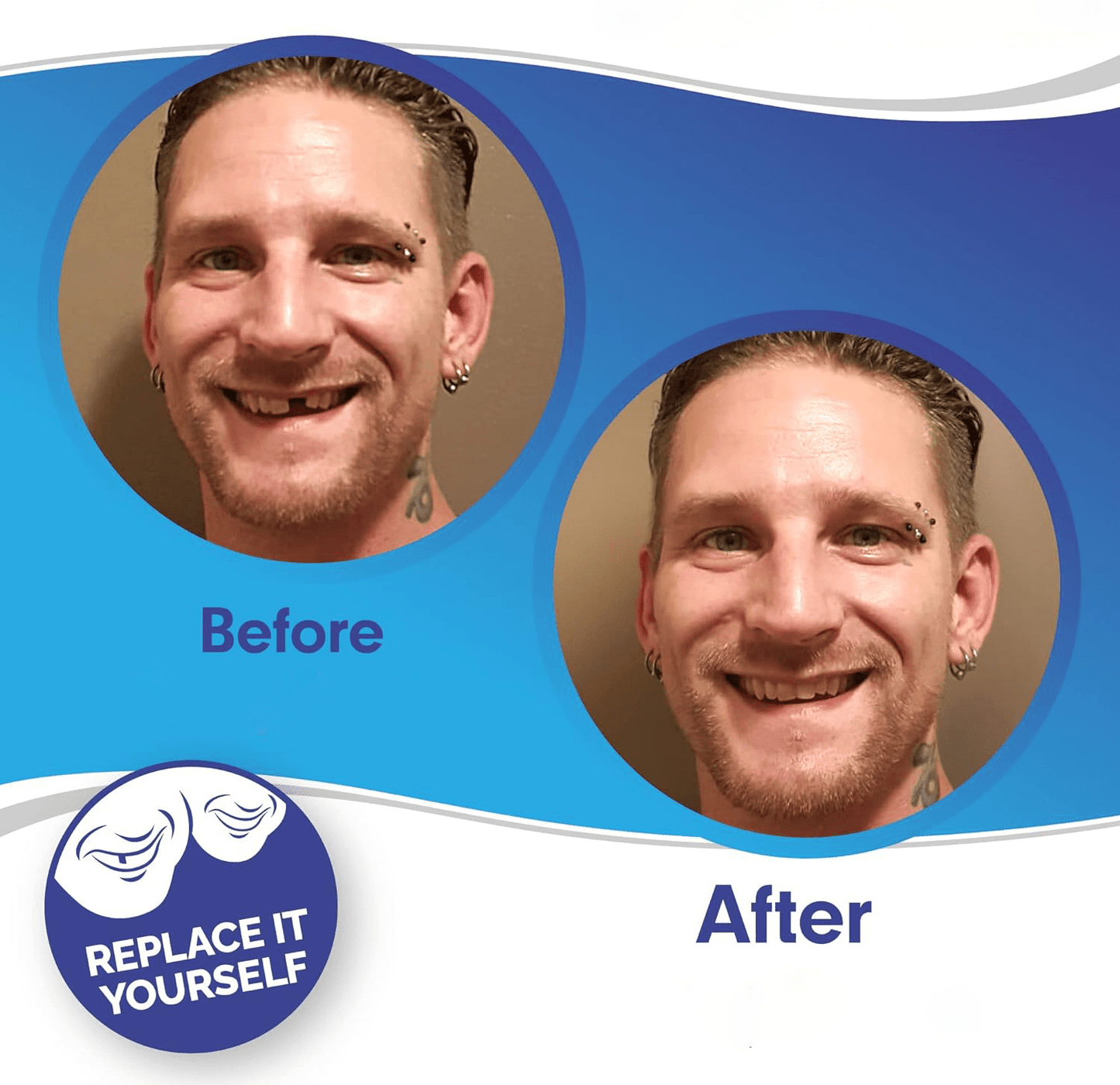 Dental Impression Smile Veneer Set for Men & Women - Lexians