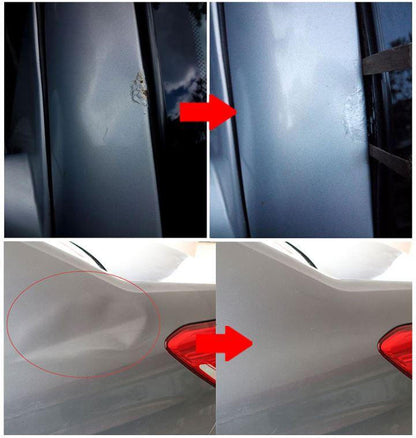 Professional Dent Removal Kit for Easy Car Repair - Lexians