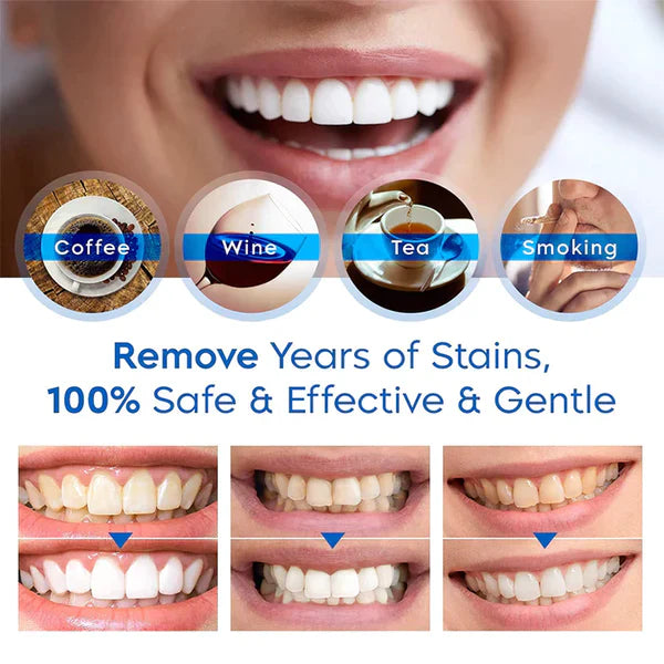 "Teeth Whitening Essence Pen, sleek design, gently removes stains, achieves bright smile, easy-to-use, sensitivity-safe."