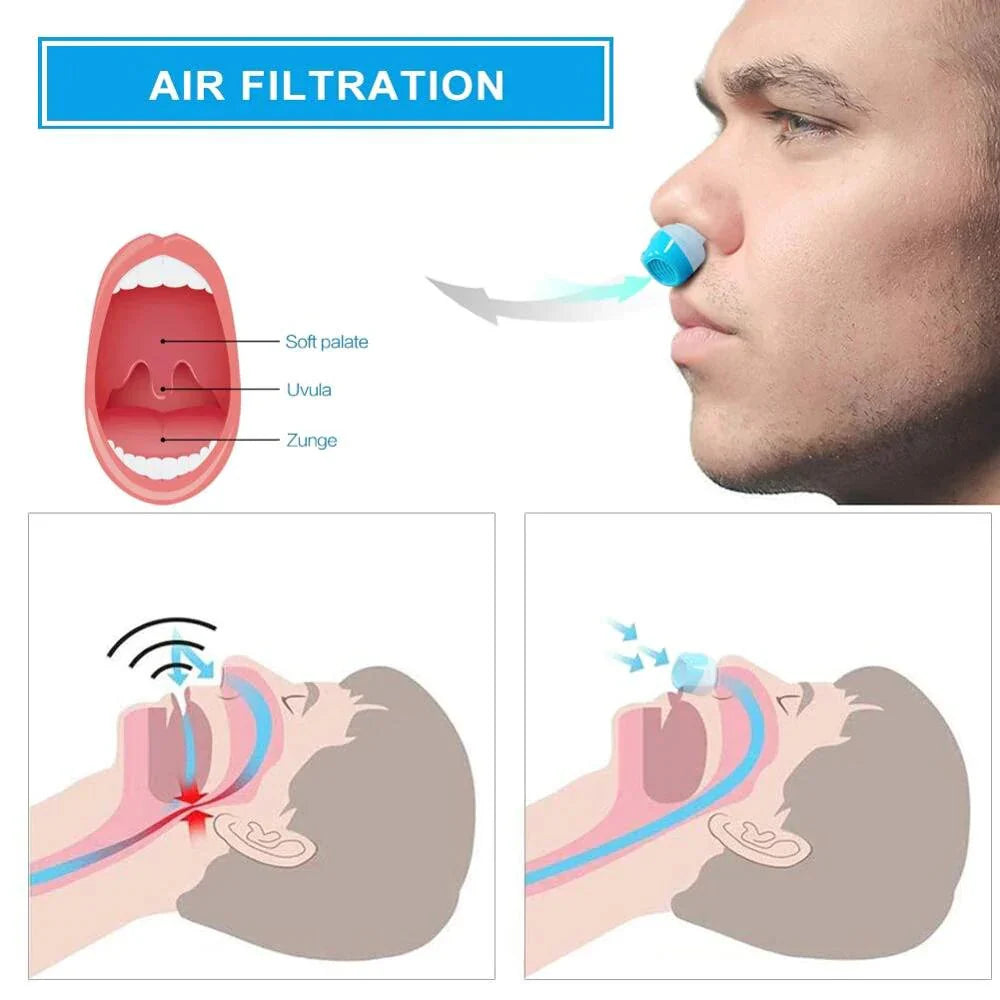 "Unisex compact anti-snoring micro-CPAP accessory, white and blue, featuring a sleek, portable design for comfortable sleep a